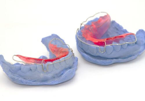 Hawley retainer and tooth mold set.