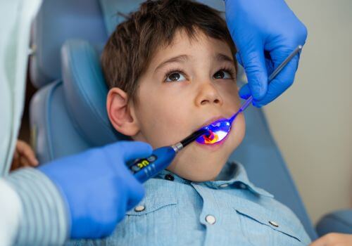 Child getting cavity filled by dental laser.