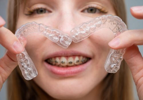 Girl with braces showing Invisalign.