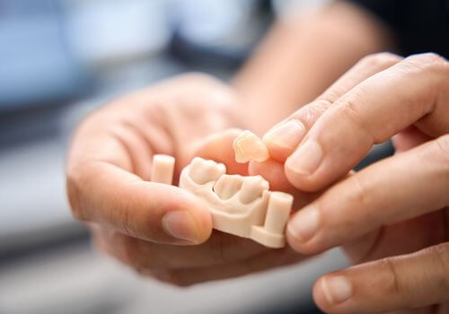 Dental crowns